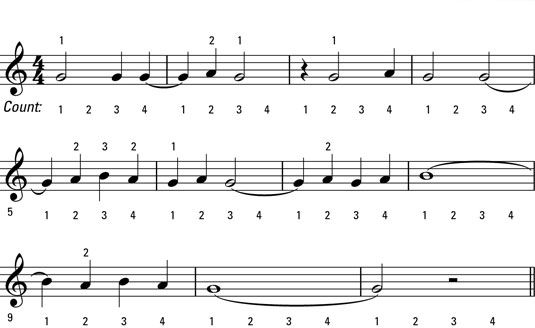 Lazos que unen las notas del mismo tono.